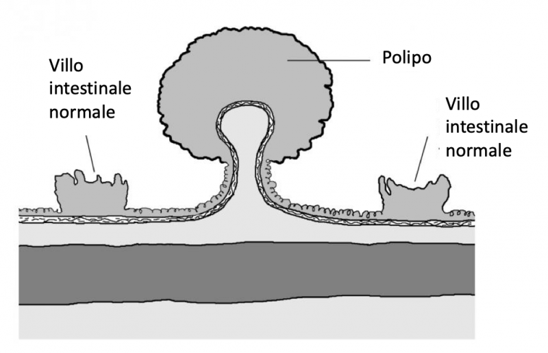 Immagine di due villi intestinali e un polipo. Fonte immagine: NIDDK