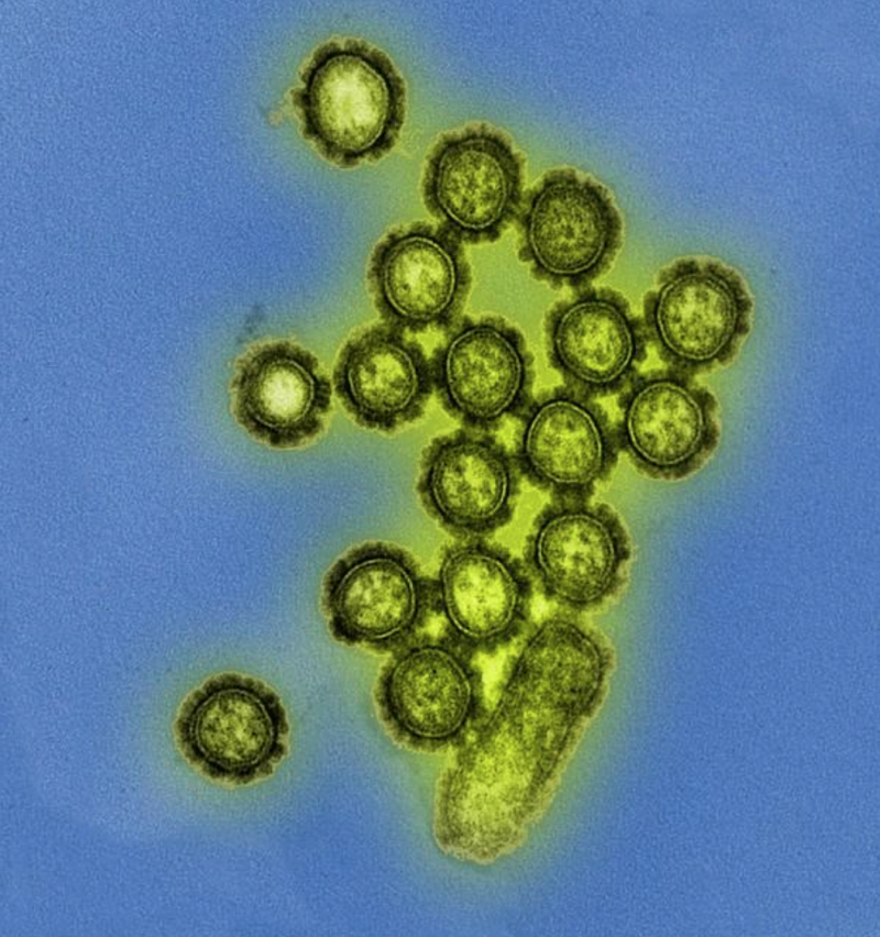Il virus dell'influenza causa milioni di malattie ogni anno. Fonte immagine: National Institute of Allergy and Infectious Diseases