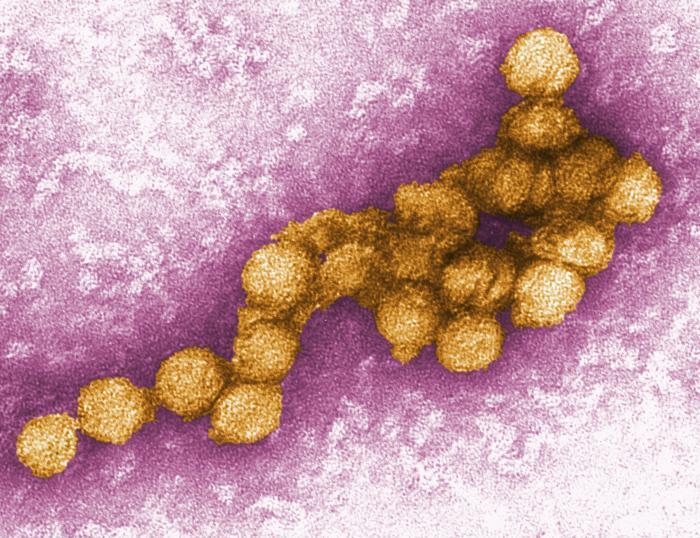 Virus West Nile. Fonte immagine: P.E. Rollin, CDC