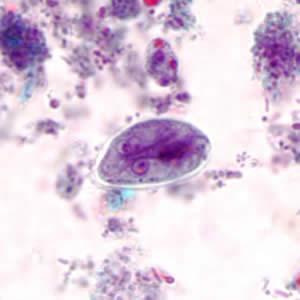 Cisti di Giardia viste al microscopio. Fonte immagine: CDC